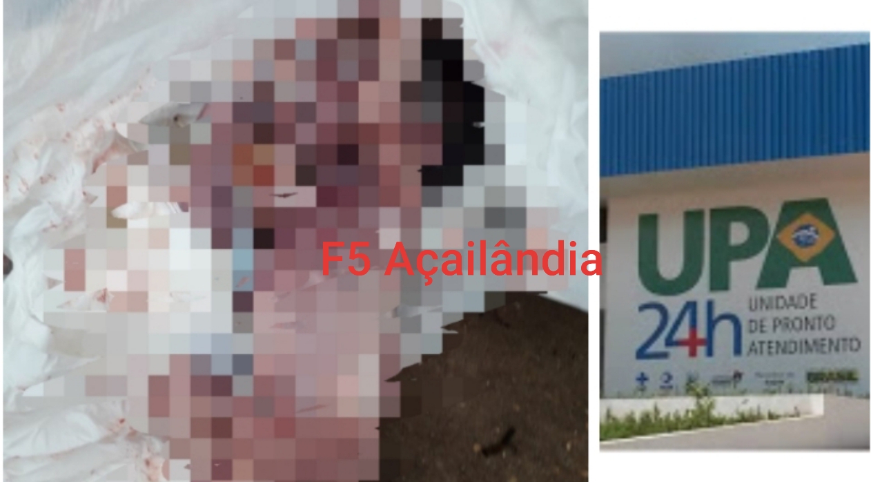 Recém nascida é encontrada dentro de lixeiro na UPA de Açailândia