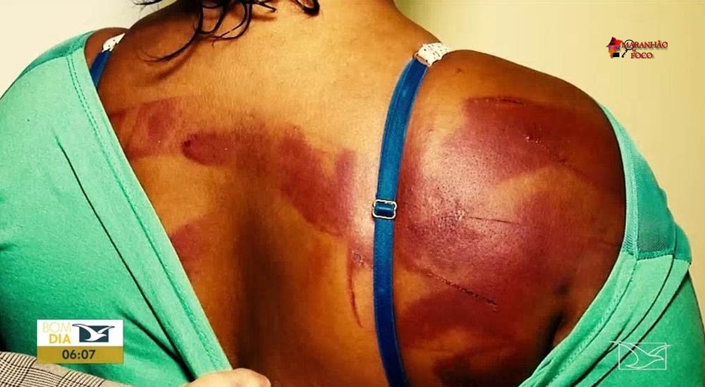 Em todos os casos de feminicídio no Maranhão, a mulher não procurou a polícia