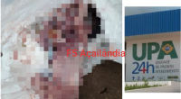 Recém nascida é encontrada dentro de lixeiro na UPA de Açailândia