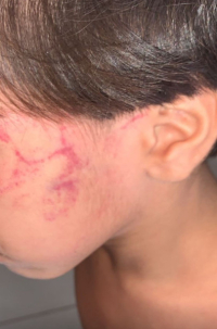 Quatro irmãos são resgatados após um deles ter sido encontrado com hematomas no rosto no Maranhão