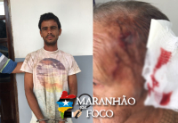 Neto é suspeito de espancar avô de 81 anos com um pedaço de madeira, em Açailândia